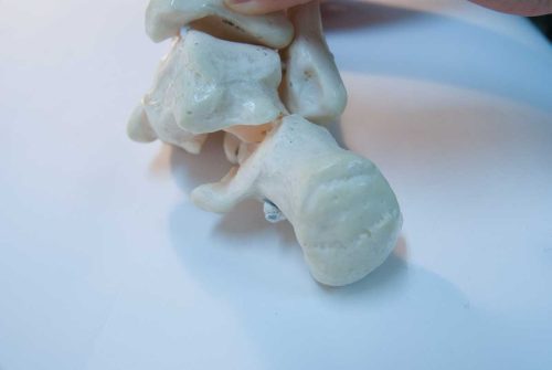 距骨下関節の過回内