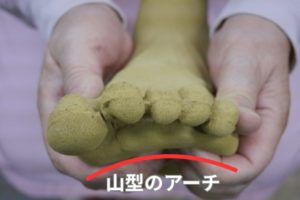 山型の横アーチ