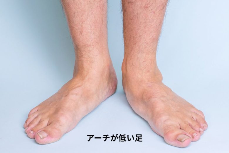 アーチが低い足